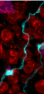 Amacrine cells under microscope