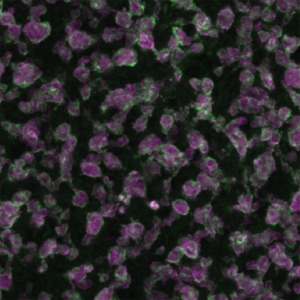 Purple, grey, and green clusters of cells against a black background