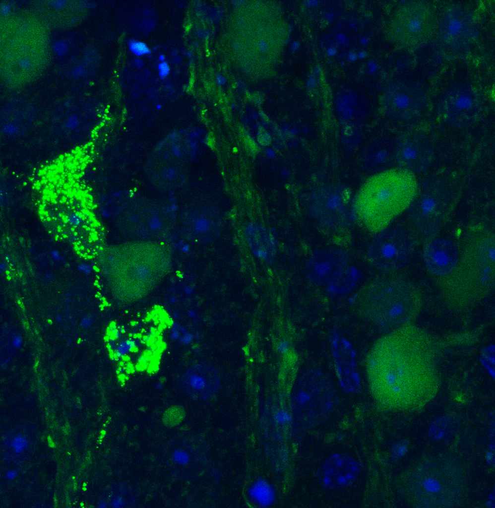 Microscopic slide of the retina several days later. Injected with a special protein to monitor translocation. Chartreuse splotches on a deep navy background.