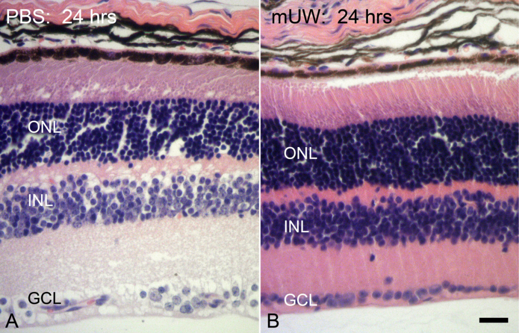 Side-by-side slides of a frozen retina that compares methods.