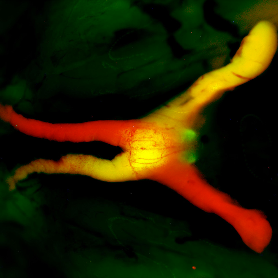 Glowing red and yellow nerve branching over a black and green mottled background.