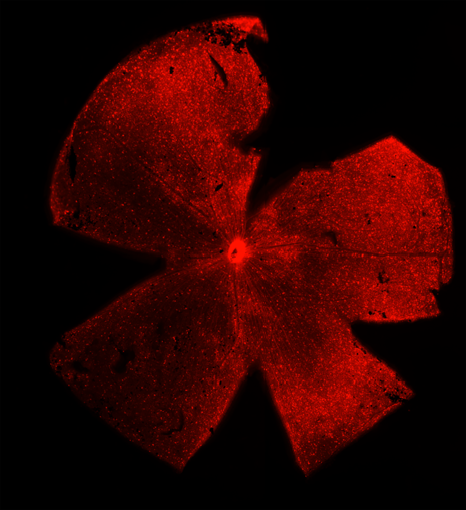 Red blooming retina under a microscope.
