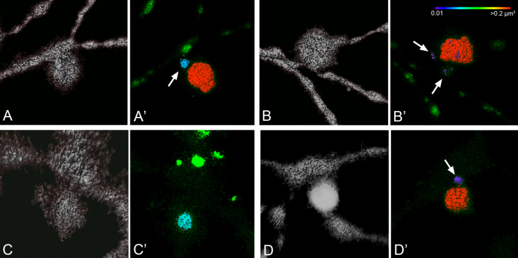 Four slides showing the progression/evulsion of dendritic arbors of ganglion cells. Black background. Gray dendritic structure with sporadic splotches of red and bright green.