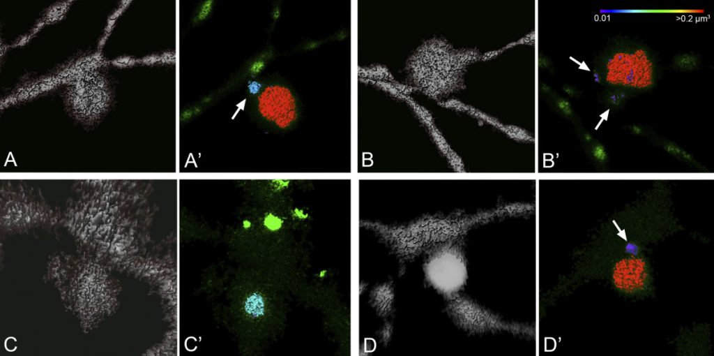 Images of Mitochondria. Four slides showing the progression/evulsion of dendritic arbors of ganglion cells. Black background. Gray dendritic structure with sporadic splotches of red and bright green.