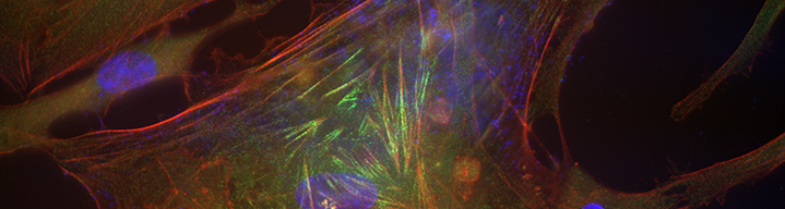 A close up of a retina showing shapes and strands of a variety of colors.